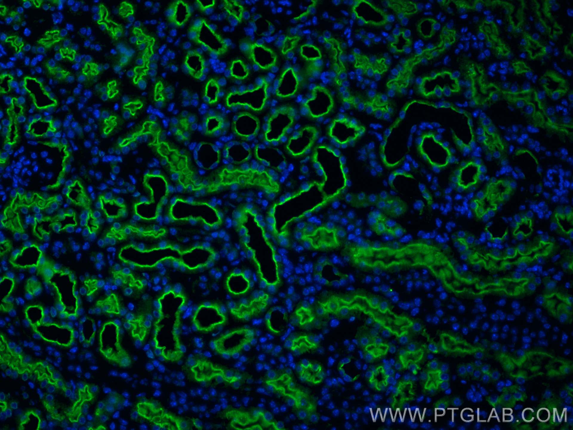 Immunofluorescence (IF) / fluorescent staining of mouse kidney tissue using DGKQ Polyclonal antibody (17885-1-AP)