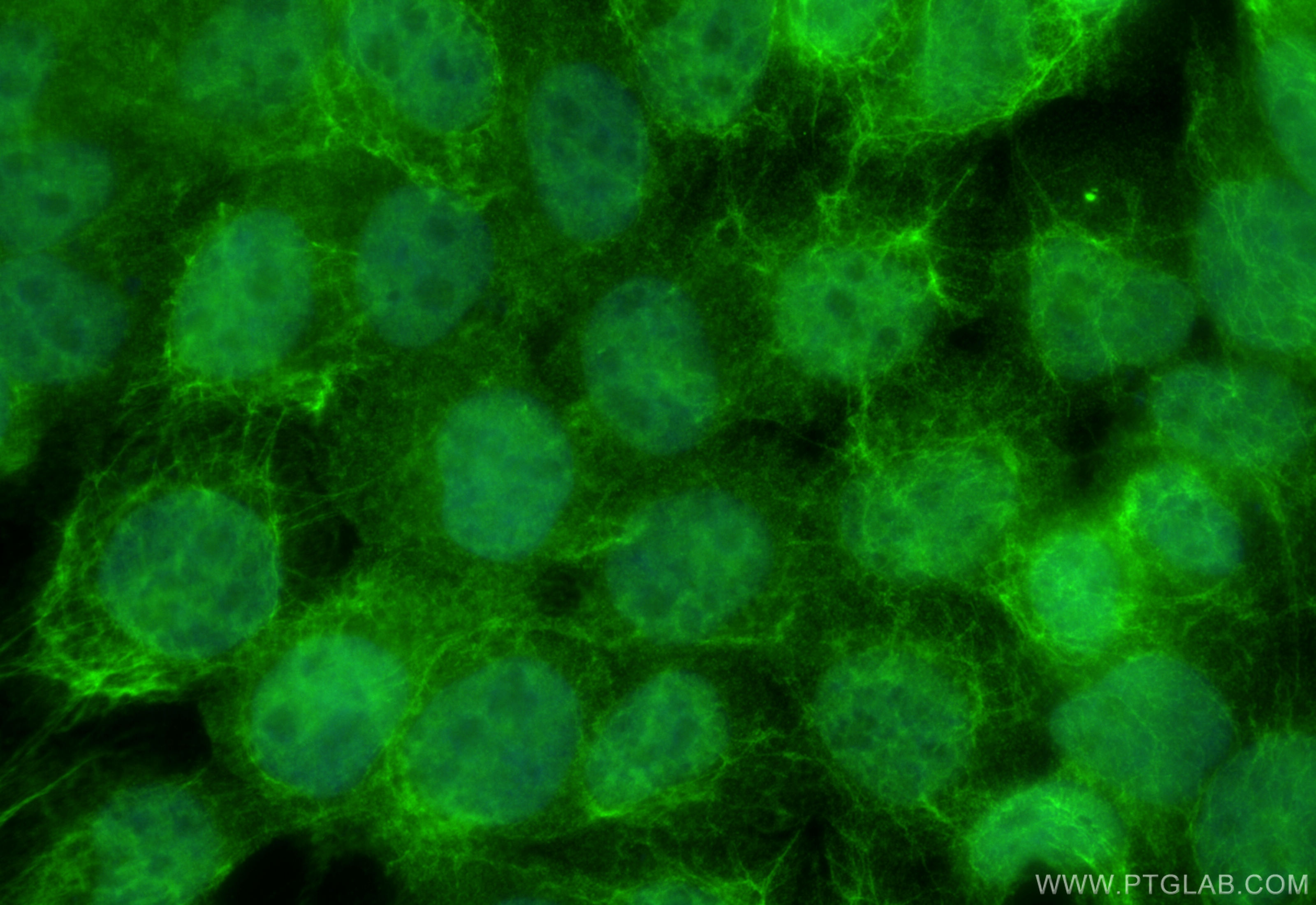 Immunofluorescence (IF) / fluorescent staining of A431 cells using DGKZ Polyclonal antibody (32124-1-AP)