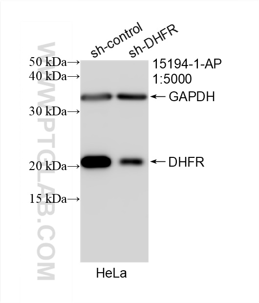 Western Blot (WB) analysis of HeLa cells using DHFR Polyclonal antibody (15194-1-AP)