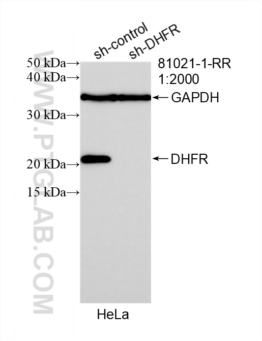 Western Blot (WB) analysis of HeLa cells using DHFR Recombinant antibody (81021-1-RR)