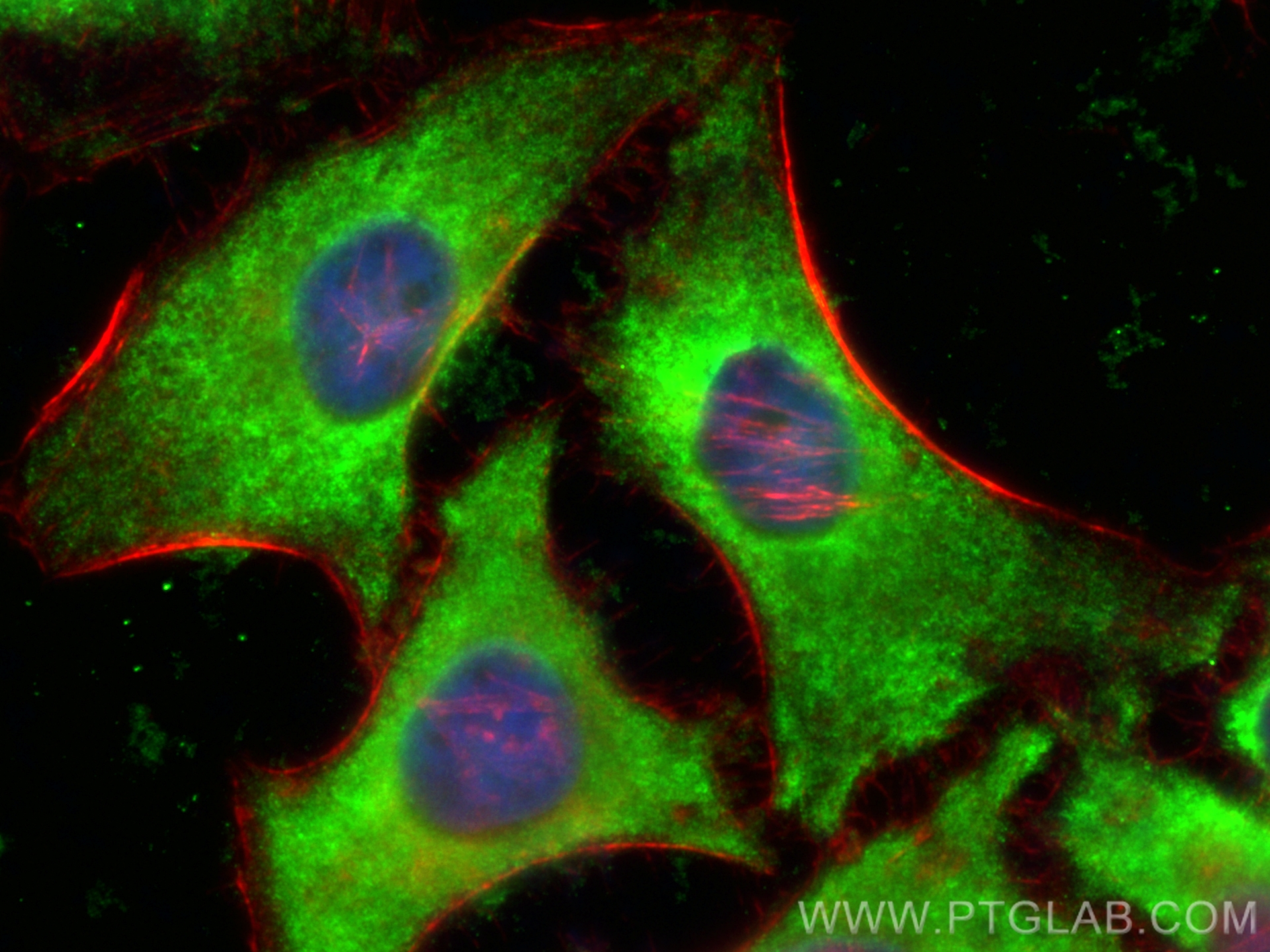 Immunofluorescence (IF) / fluorescent staining of HeLa cells using CoraLite® Plus 488-conjugated DHPS Polyclonal anti (CL488-11184)