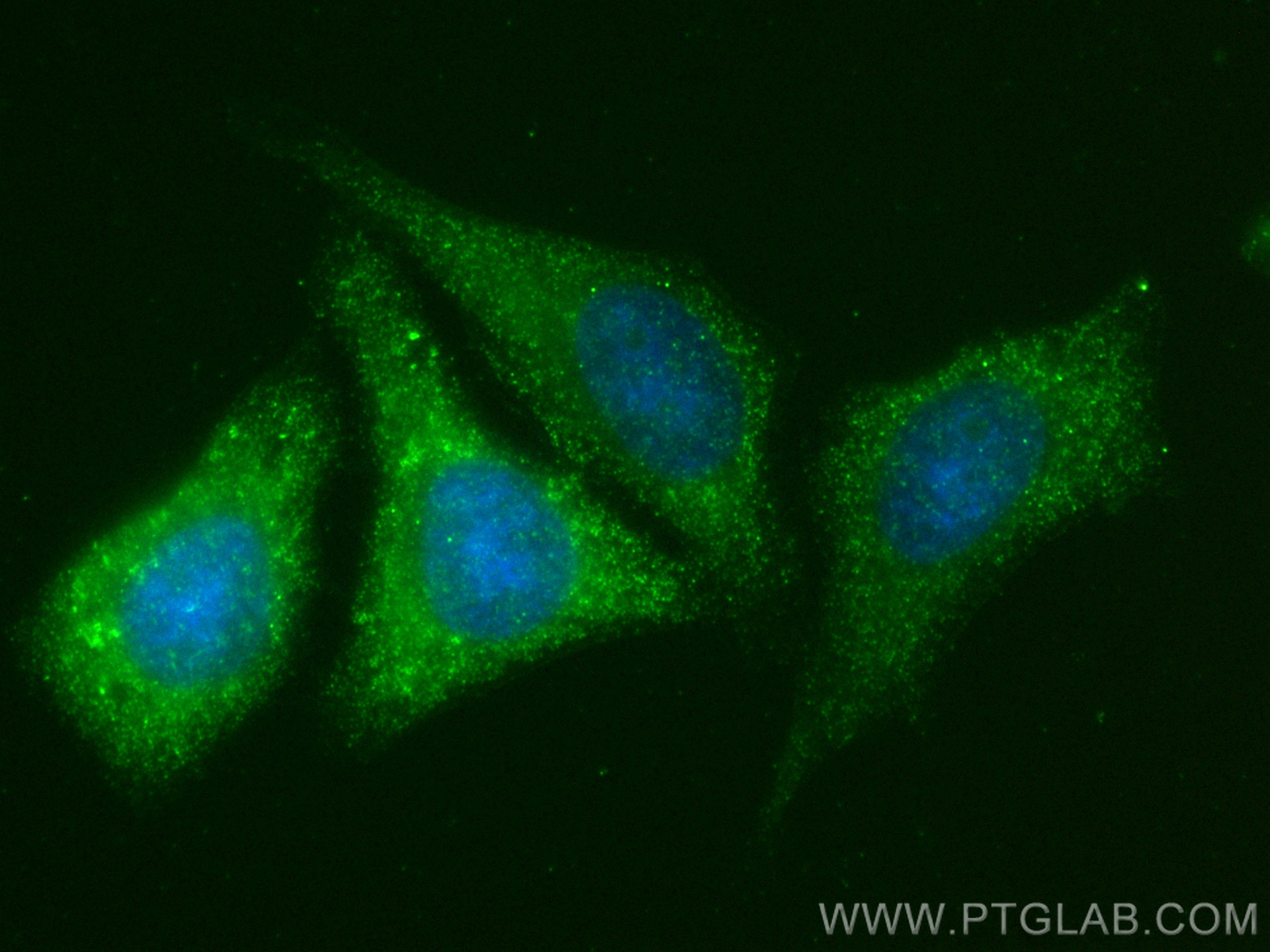 Immunofluorescence (IF) / fluorescent staining of HepG2 cells using DHRS3 Recombinant antibody (83581-3-RR)