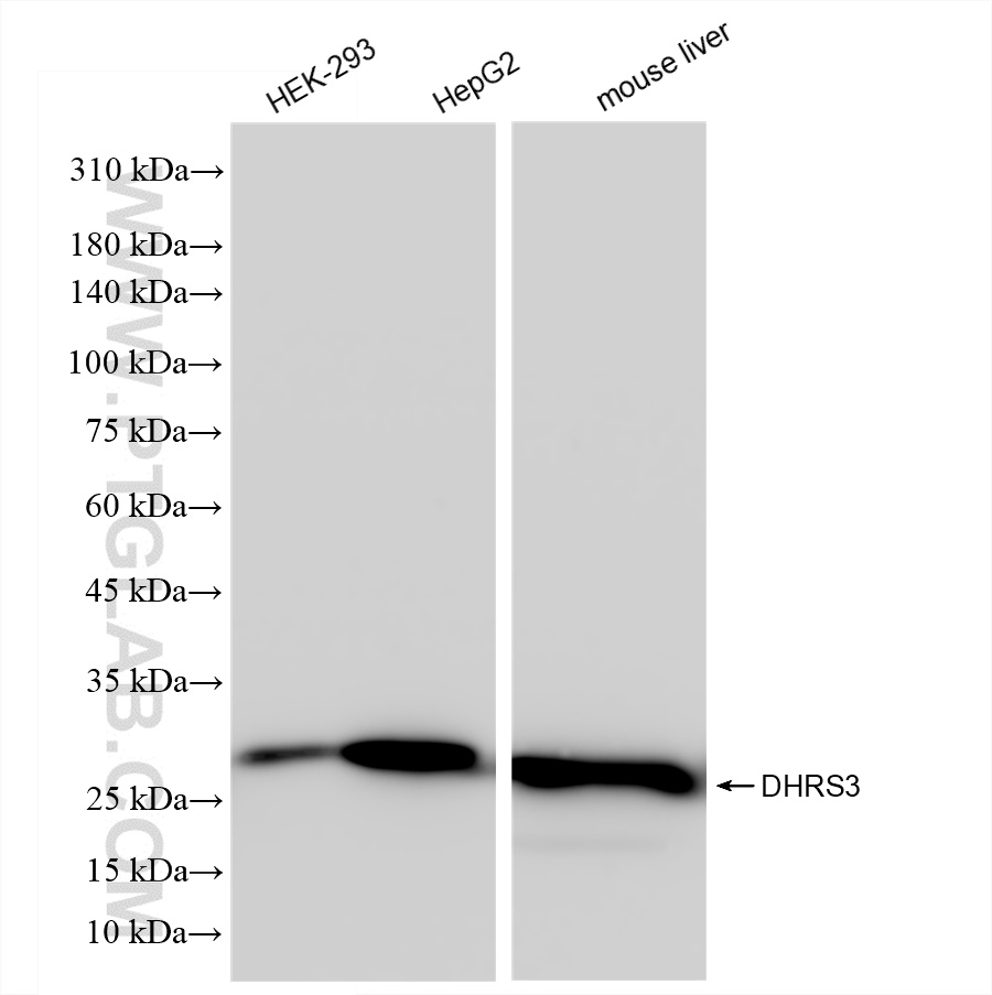 Western Blot (WB) analysis of various lysates using DHRS3 Recombinant antibody (83581-3-RR)