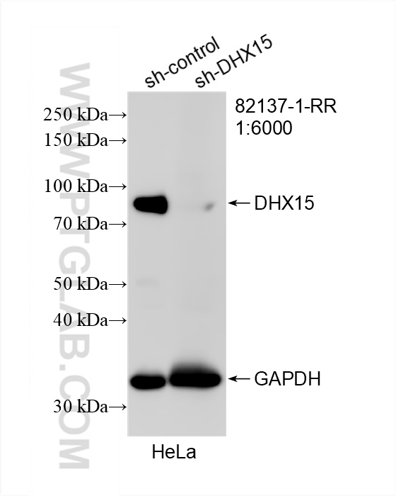 Western Blot (WB) analysis of HeLa cells using DHX15 Recombinant antibody (82137-1-RR)