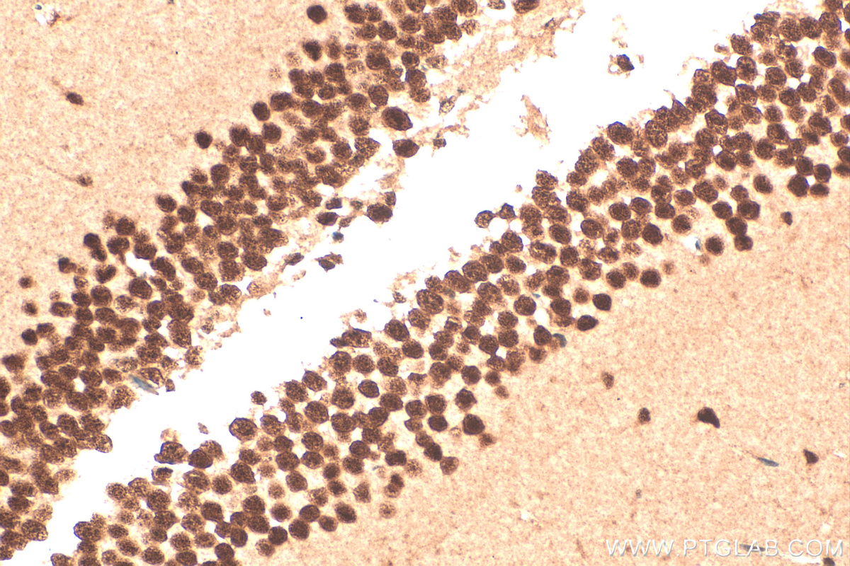 Immunohistochemistry (IHC) staining of mouse brain tissue using DHX9 Polyclonal antibody (17721-1-AP)