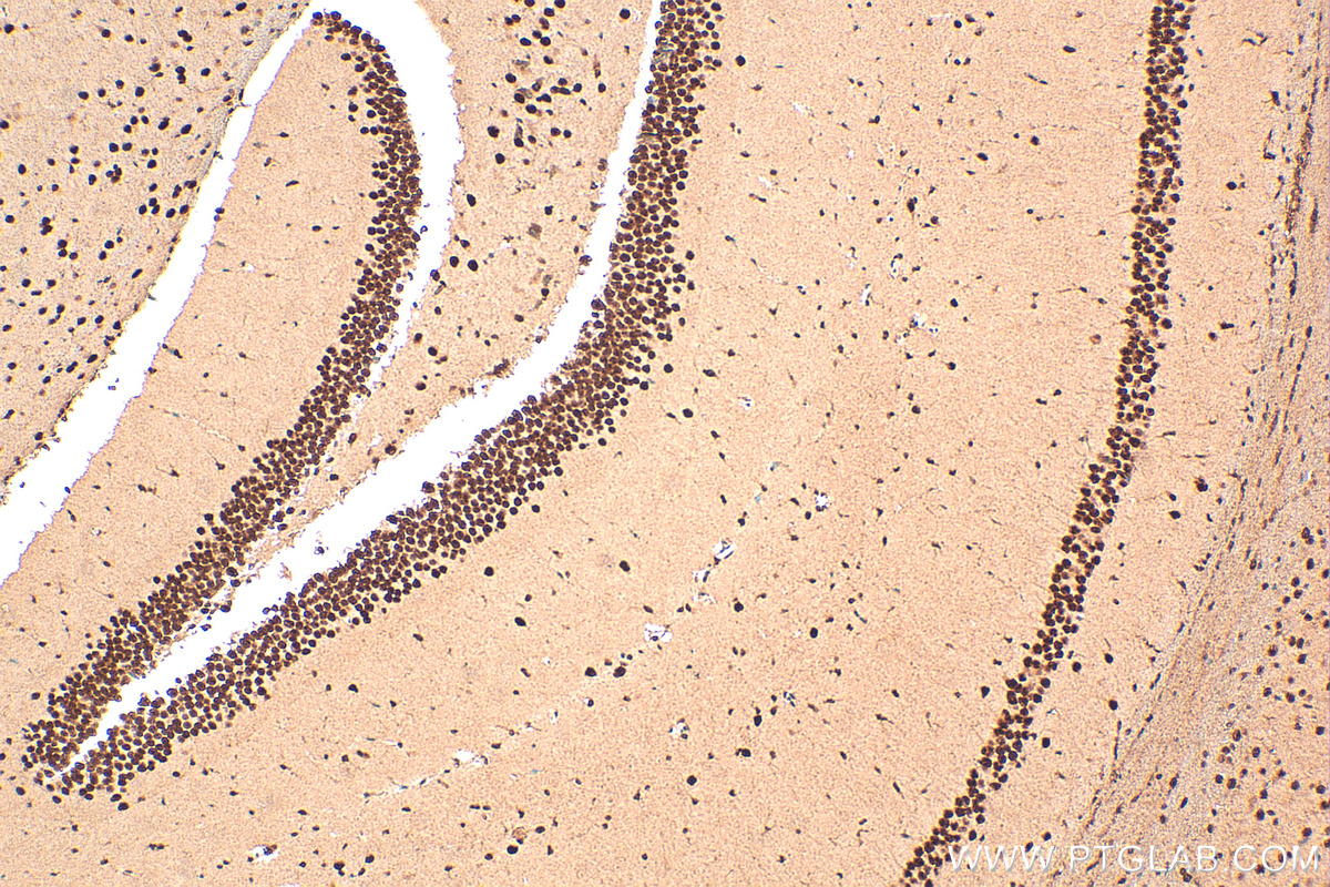 Immunohistochemistry (IHC) staining of mouse brain tissue using DHX9 Polyclonal antibody (17721-1-AP)