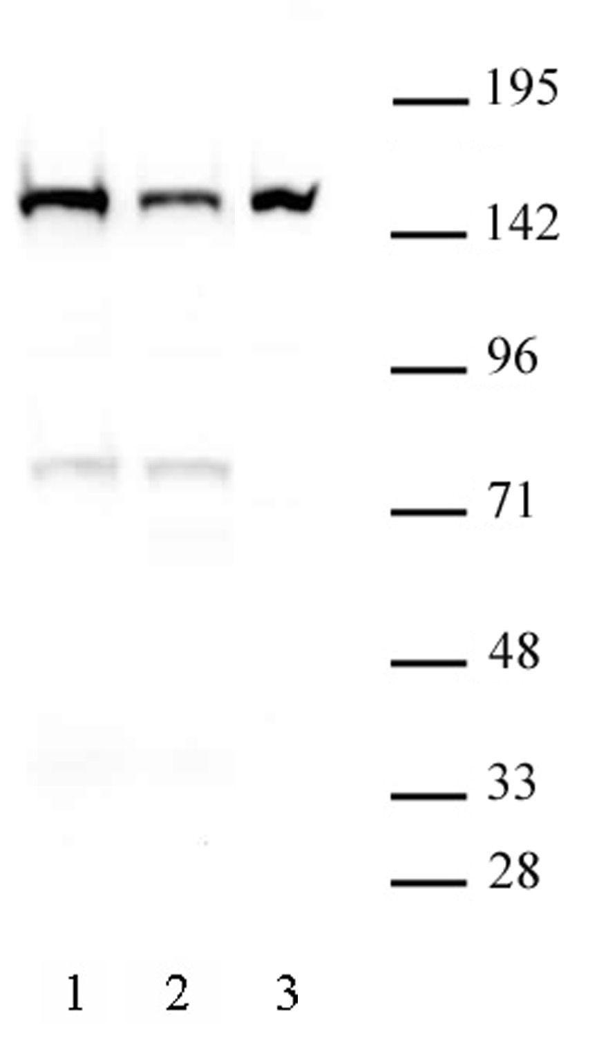 DHX9 antibody (mAb) (Clone 8E3) tested by Western blot. DHX9 antibody detection by Western blot. The analysis was performed using 30 ug of either NIH-3T3 nuclear extract (lane 1), NIH-3T3 cytoplasmic extract (lane 2), or HeLa nuclear extract (lane 3) and DHX9 antibody (mAb) at a 2 ug/ml dilution.