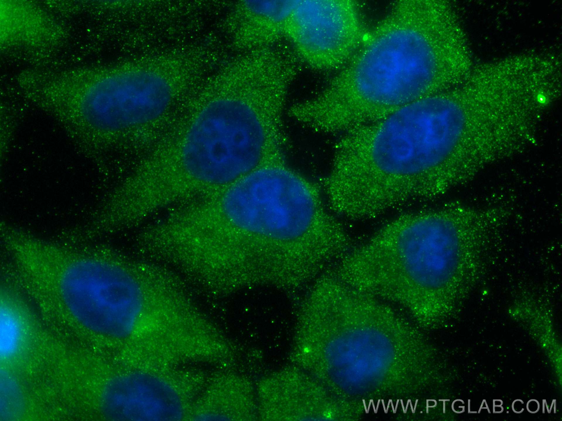 Immunofluorescence (IF) / fluorescent staining of HepG2 cells using DICER1 Polyclonal antibody (20567-1-AP)