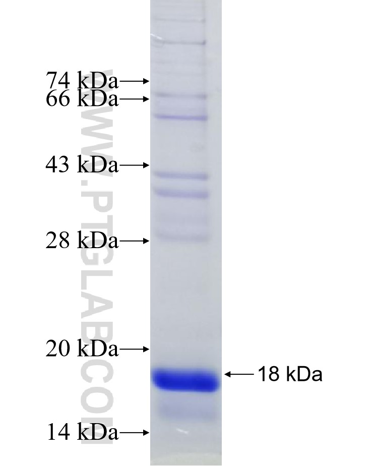 DICER1 fusion protein Ag30368 SDS-PAGE