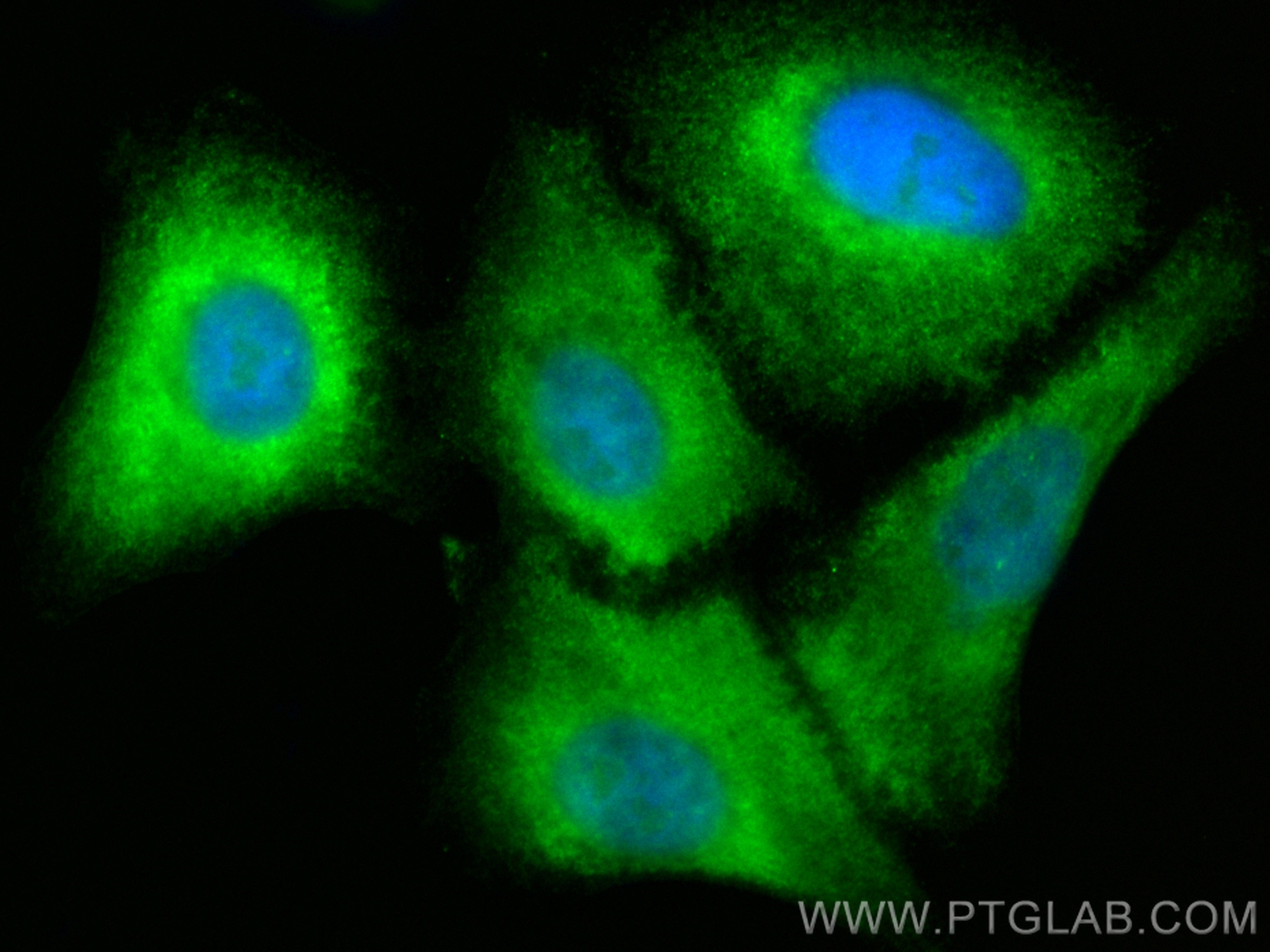 Immunofluorescence (IF) / fluorescent staining of A549 cells using CoraLite® Plus 488-conjugated DIO1 Polyclonal anti (CL488-11790)