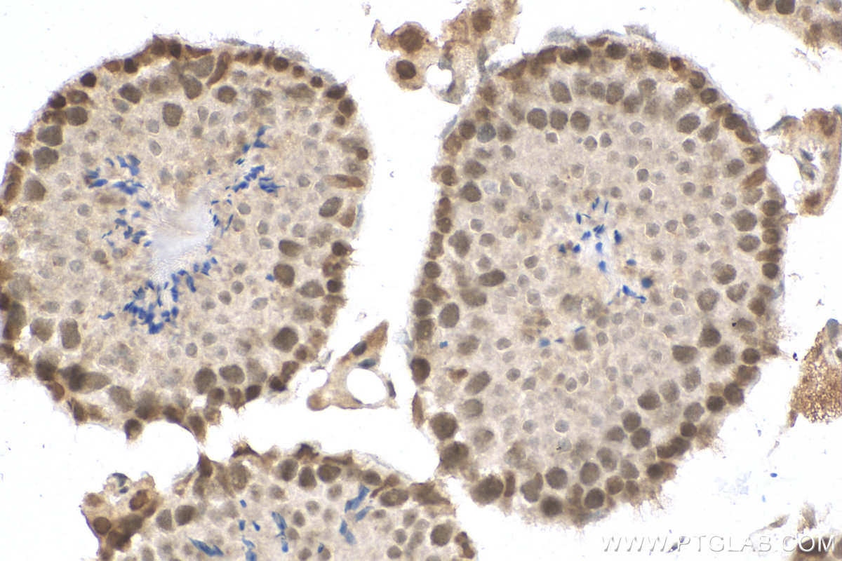 Immunohistochemistry (IHC) staining of mouse testis tissue using DIS3 Polyclonal antibody (29664-1-AP)