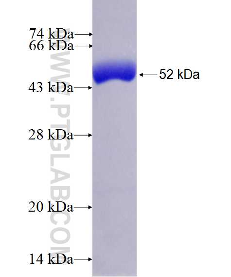 DKFZp686O24166 fusion protein Ag26532 SDS-PAGE