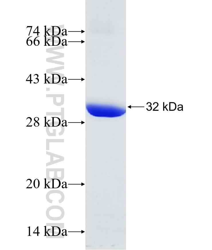 DKFZp686O24166 fusion protein Ag26558 SDS-PAGE