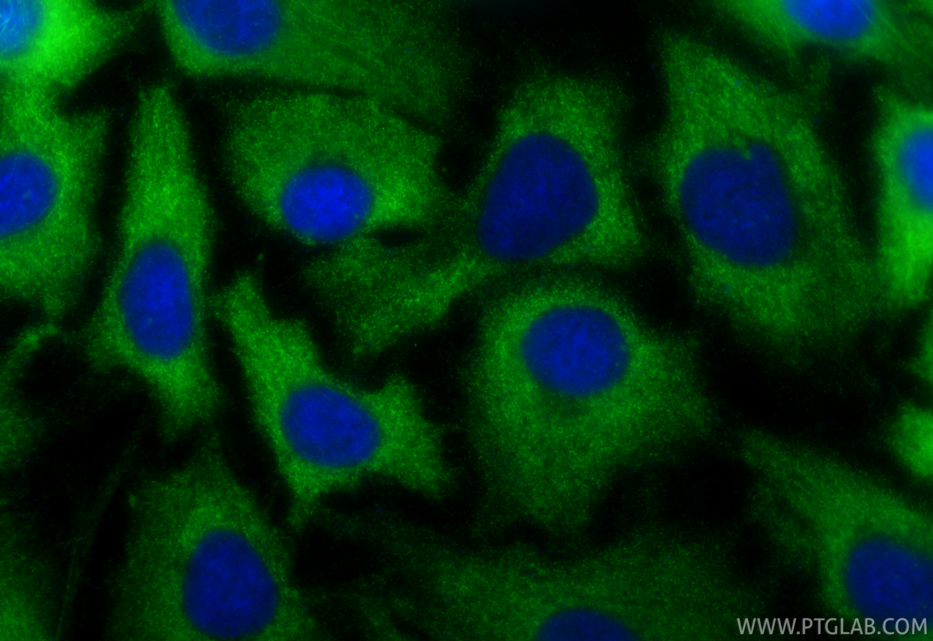 Immunofluorescence (IF) / fluorescent staining of A549 cells using CoraLite® Plus 488-conjugated DKK3 Polyclonal anti (CL488-10365)