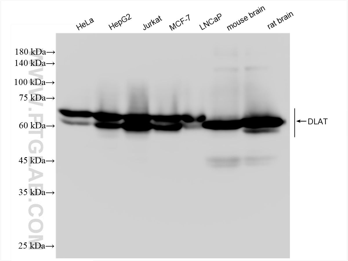 Western Blot (WB) analysis of various lysates using DLAT Recombinant antibody (83654-3-RR)