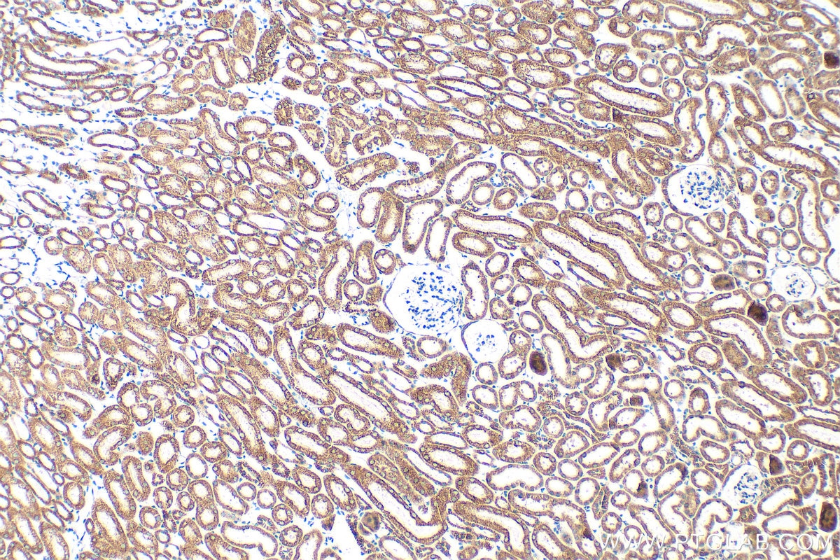 Immunohistochemistry (IHC) staining of mouse kidney tissue using DLD Polyclonal antibody (16431-1-AP)