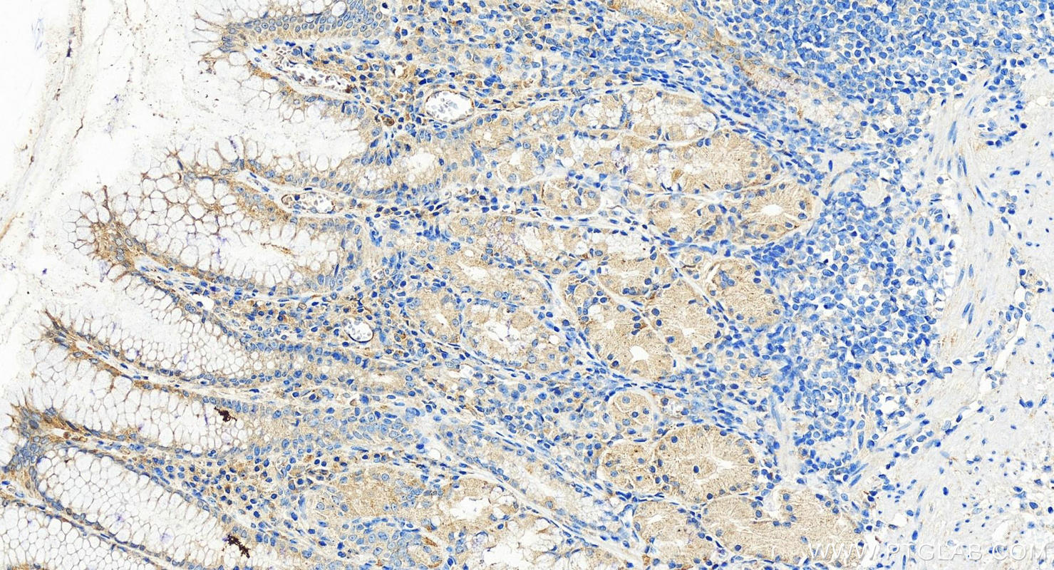 Immunohistochemistry (IHC) staining of human stomach tissue using DLGAP3 Polyclonal antibody (55056-1-AP)