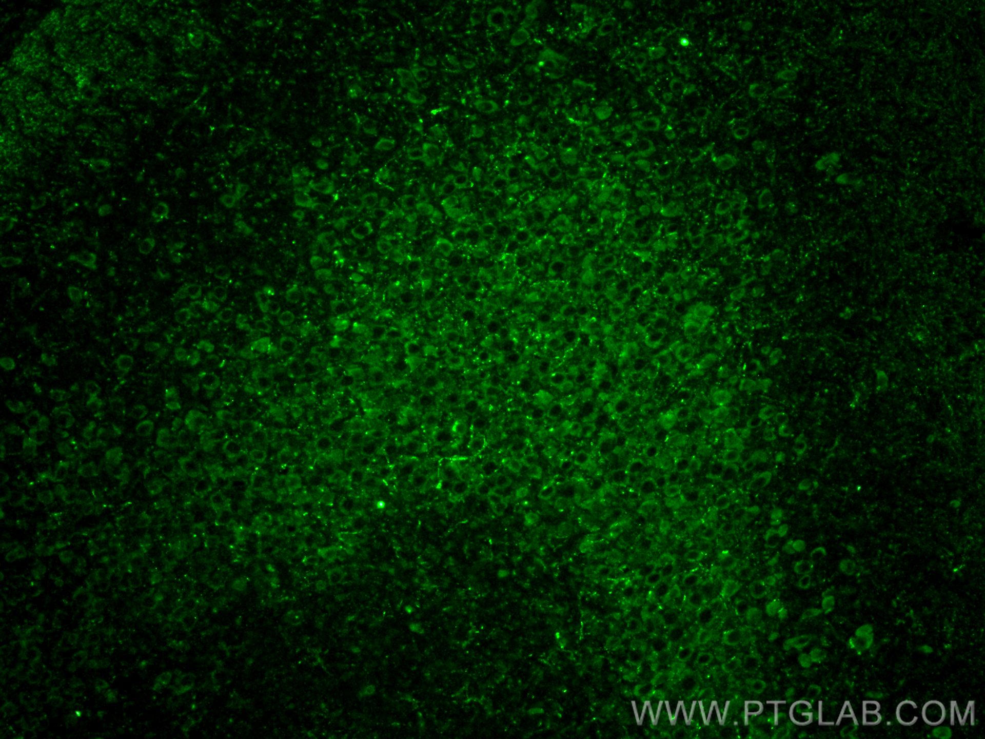 Immunofluorescence (IF) / fluorescent staining of mouse brain tissue using DLL3 Polyclonal antibody (25535-1-AP)