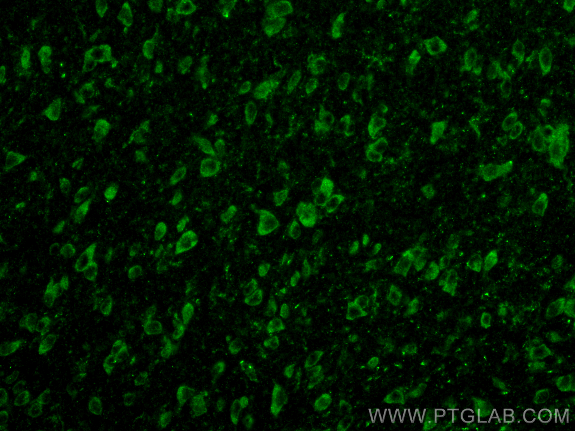 Immunofluorescence (IF) / fluorescent staining of mouse brain tissue using DLL3 Polyclonal antibody (25535-1-AP)