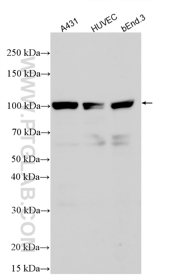 Western Blot (WB) analysis of various lysates using DLL4 Polyclonal antibody (21584-1-AP)