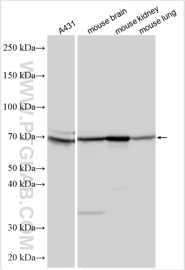 Western Blot (WB) analysis of various lysates using DLL4 Polyclonal antibody (32331-1-AP)