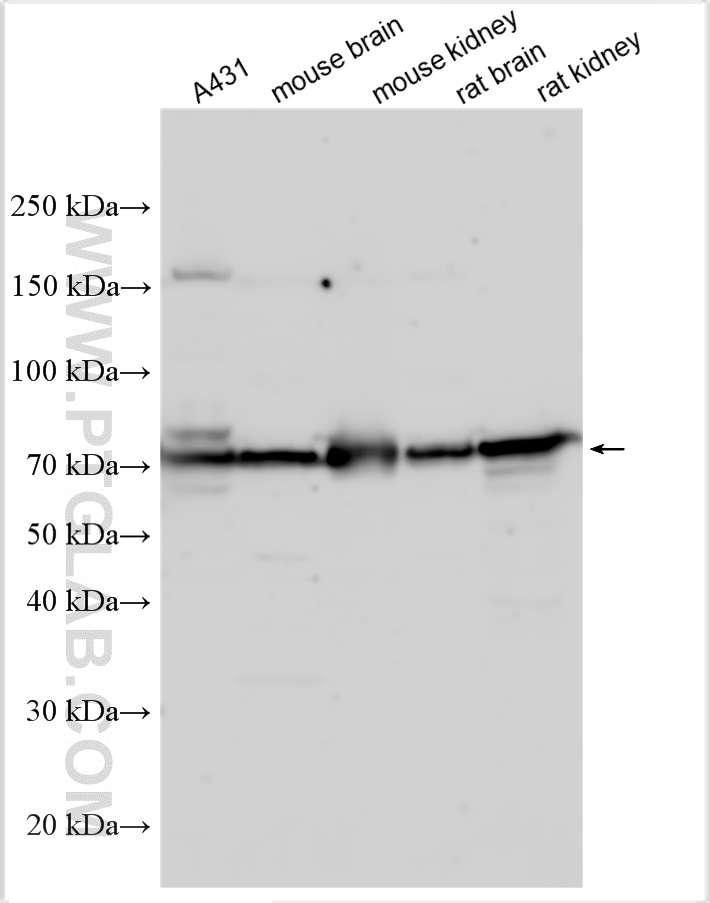 Western Blot (WB) analysis of various lysates using DLL4 Polyclonal antibody (32331-1-AP)