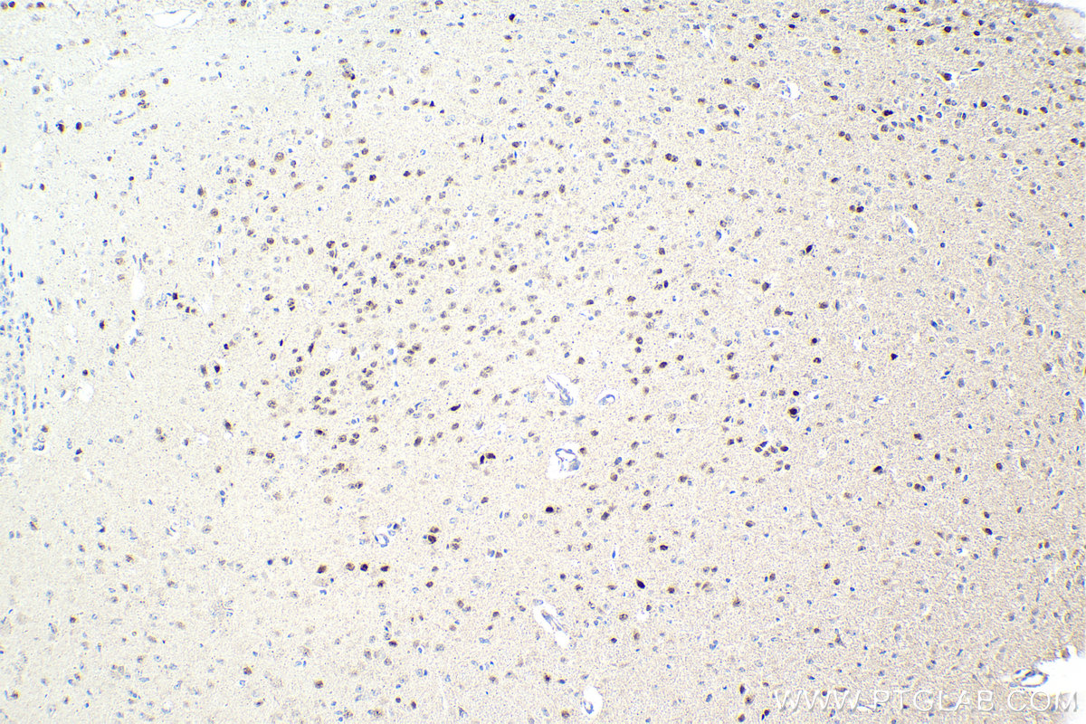 Immunohistochemistry (IHC) staining of mouse brain tissue using DLX1 Polyclonal antibody (13046-1-AP)