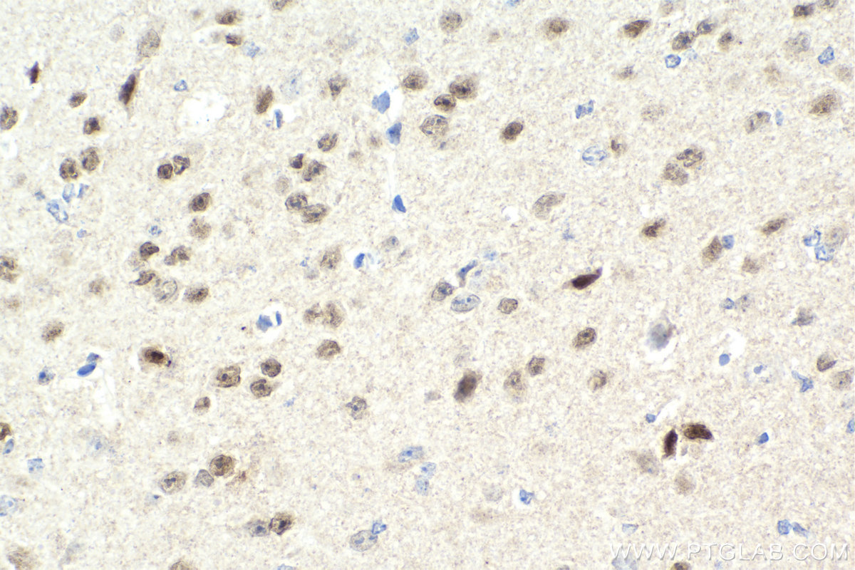 Immunohistochemistry (IHC) staining of mouse brain tissue using DLX1 Polyclonal antibody (13046-1-AP)