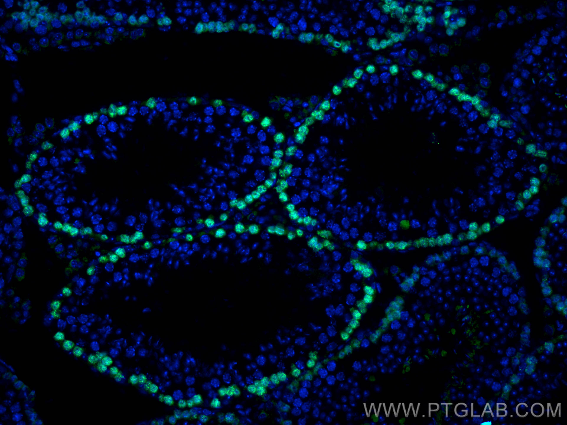 Immunofluorescence (IF) / fluorescent staining of mouse testis tissue using DMC1 Polyclonal antibody (13714-1-AP)