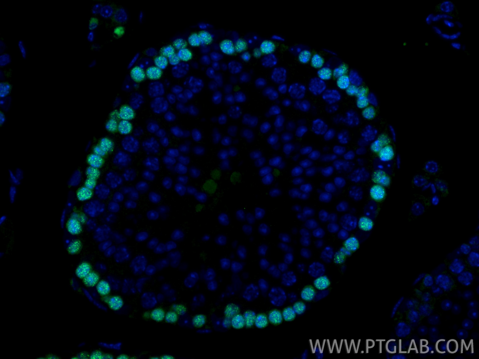 Immunofluorescence (IF) / fluorescent staining of mouse testis tissue using DMC1 Polyclonal antibody (13714-1-AP)
