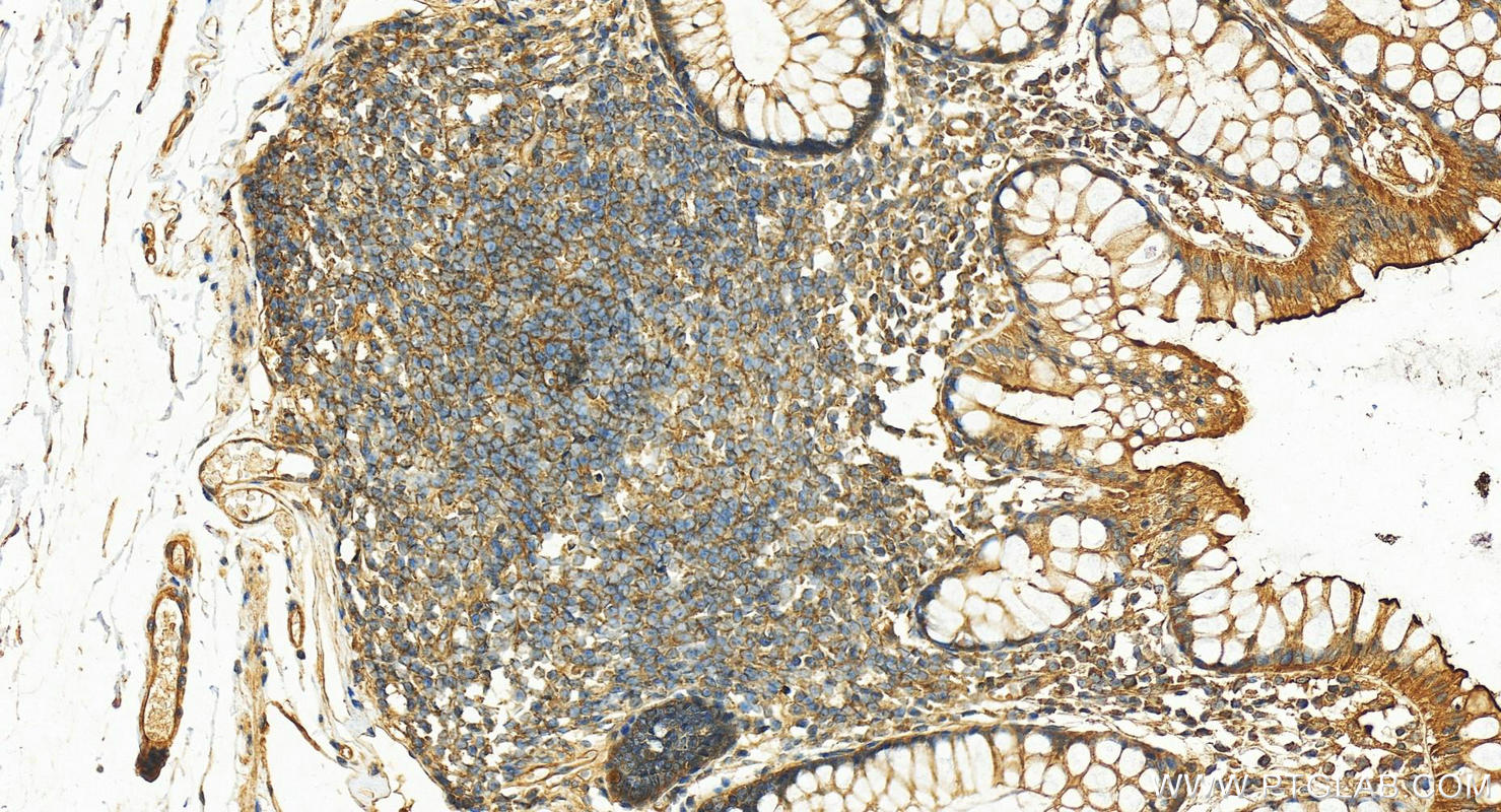 Immunohistochemistry (IHC) staining of human normal colon using Dystrophin Polyclonal antibody (12715-1-AP)