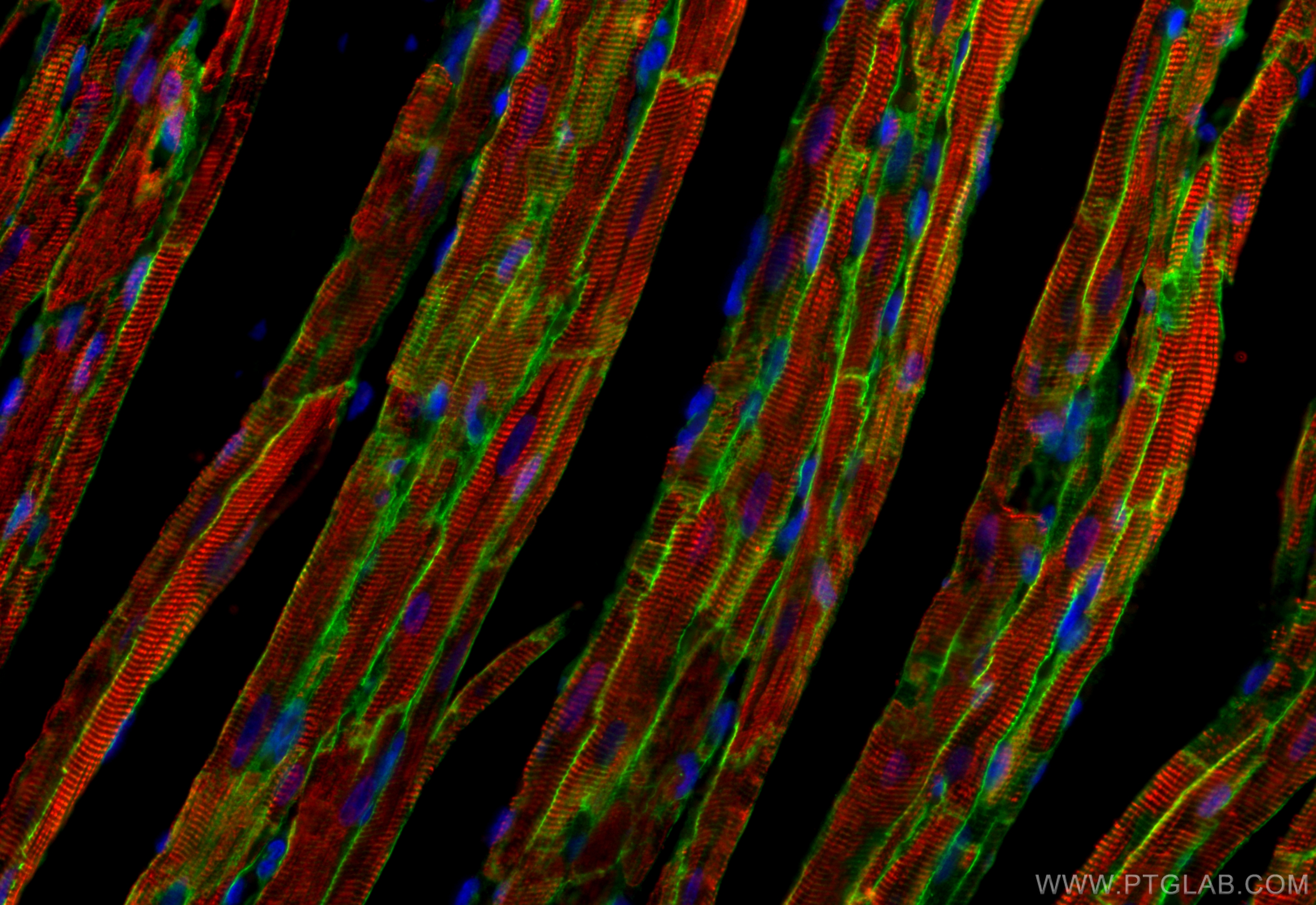 Immunofluorescence (IF) / fluorescent staining of rat heart tissue using Dystrophin Polyclonal antibody (12715-1-AP)