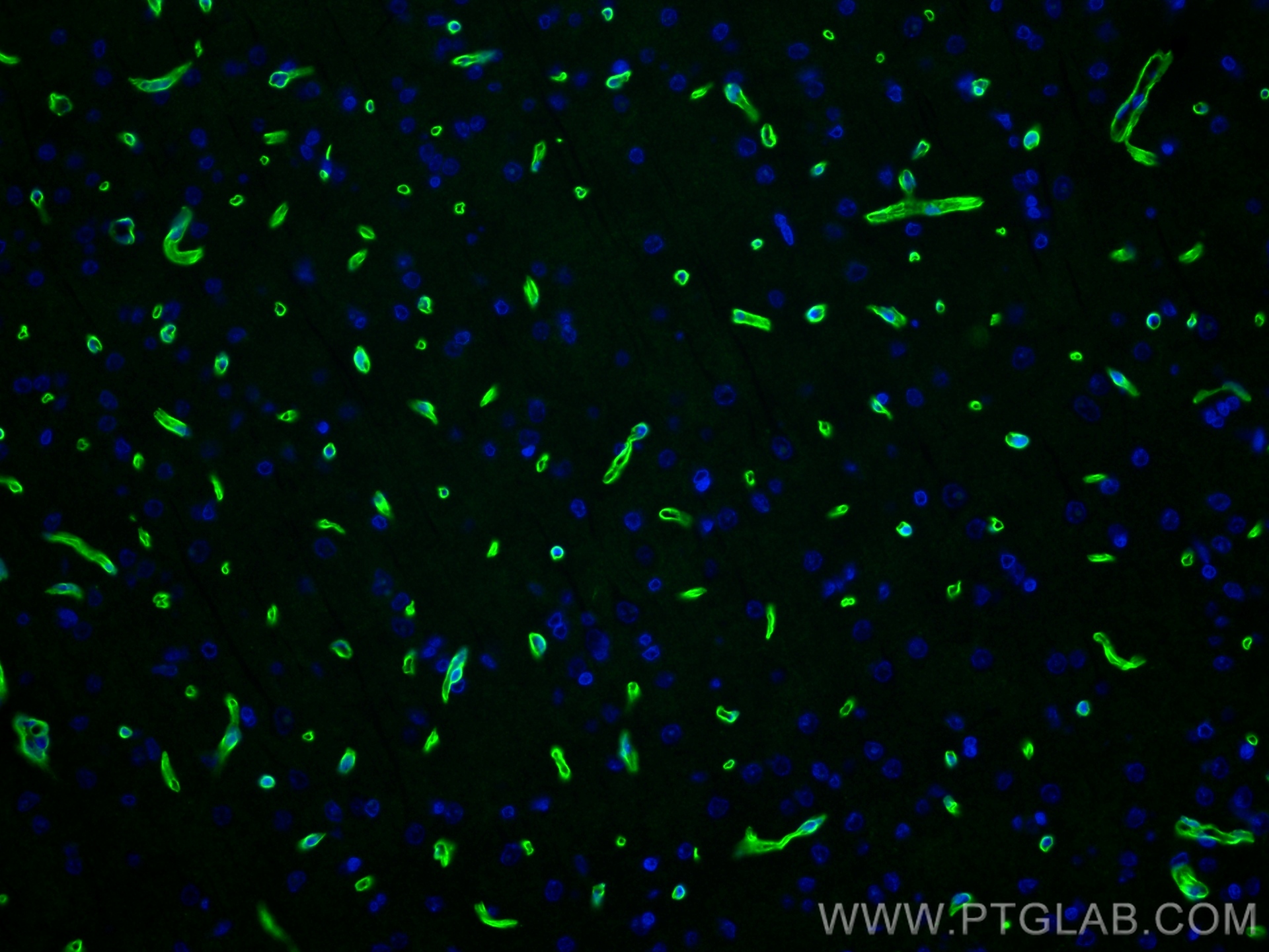 Immunofluorescence (IF) / fluorescent staining of rat brain tissue using Dystrophin Recombinant antibody (83609-6-RR)