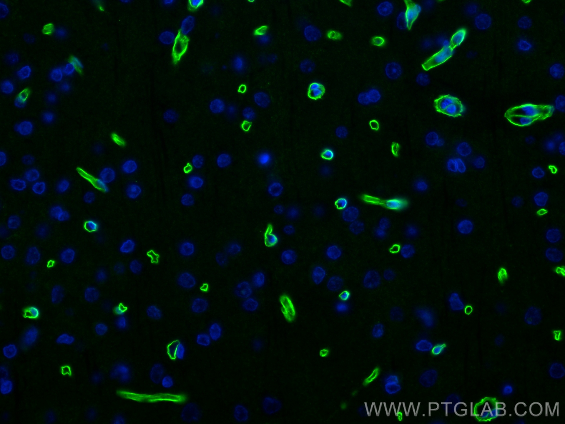 Immunofluorescence (IF) / fluorescent staining of rat brain tissue using Dystrophin Recombinant antibody (83609-6-RR)