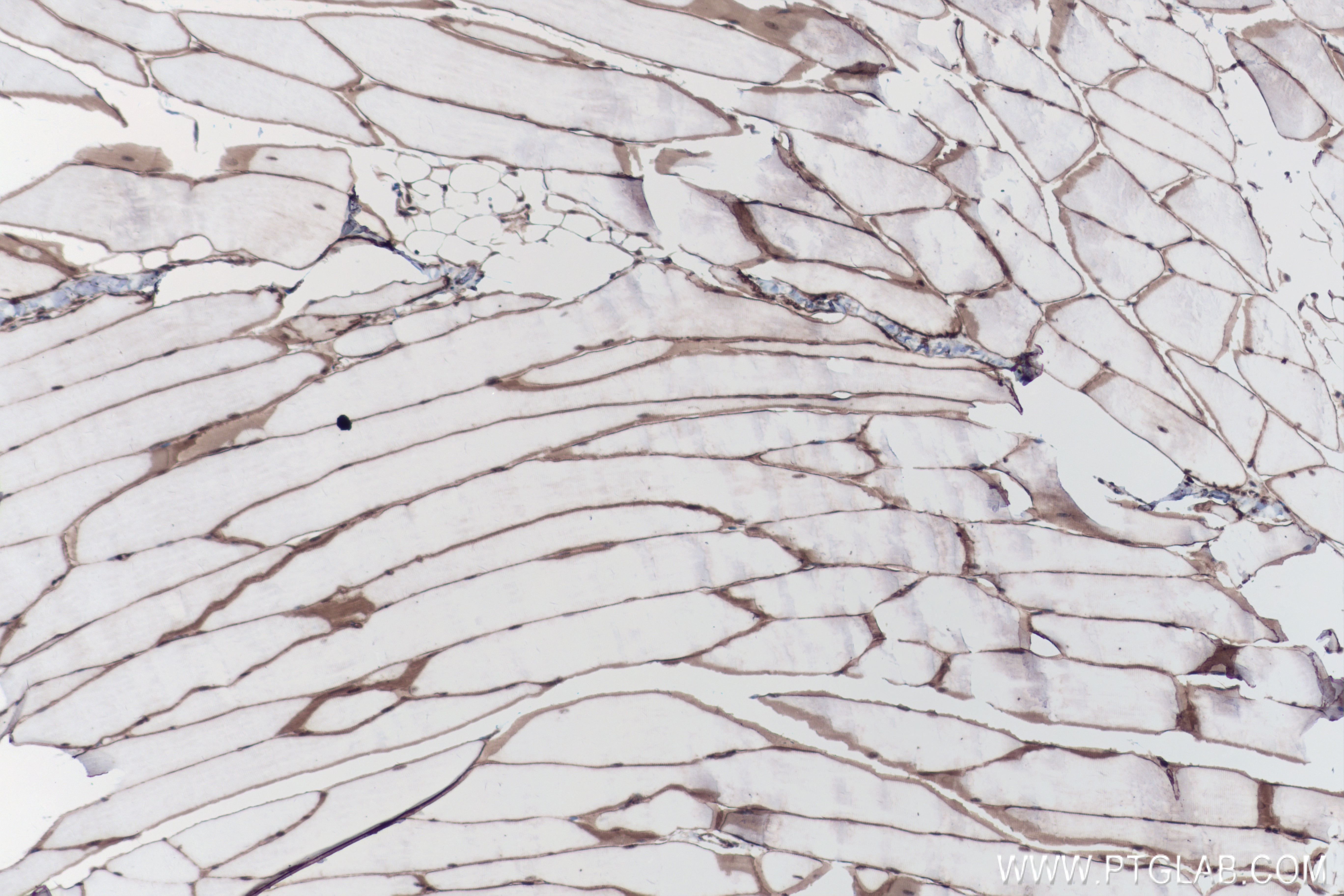 Immunohistochemistry (IHC) staining of mouse skeletal muscle tissue using Dystrophin Recombinant antibody (83609-6-RR)