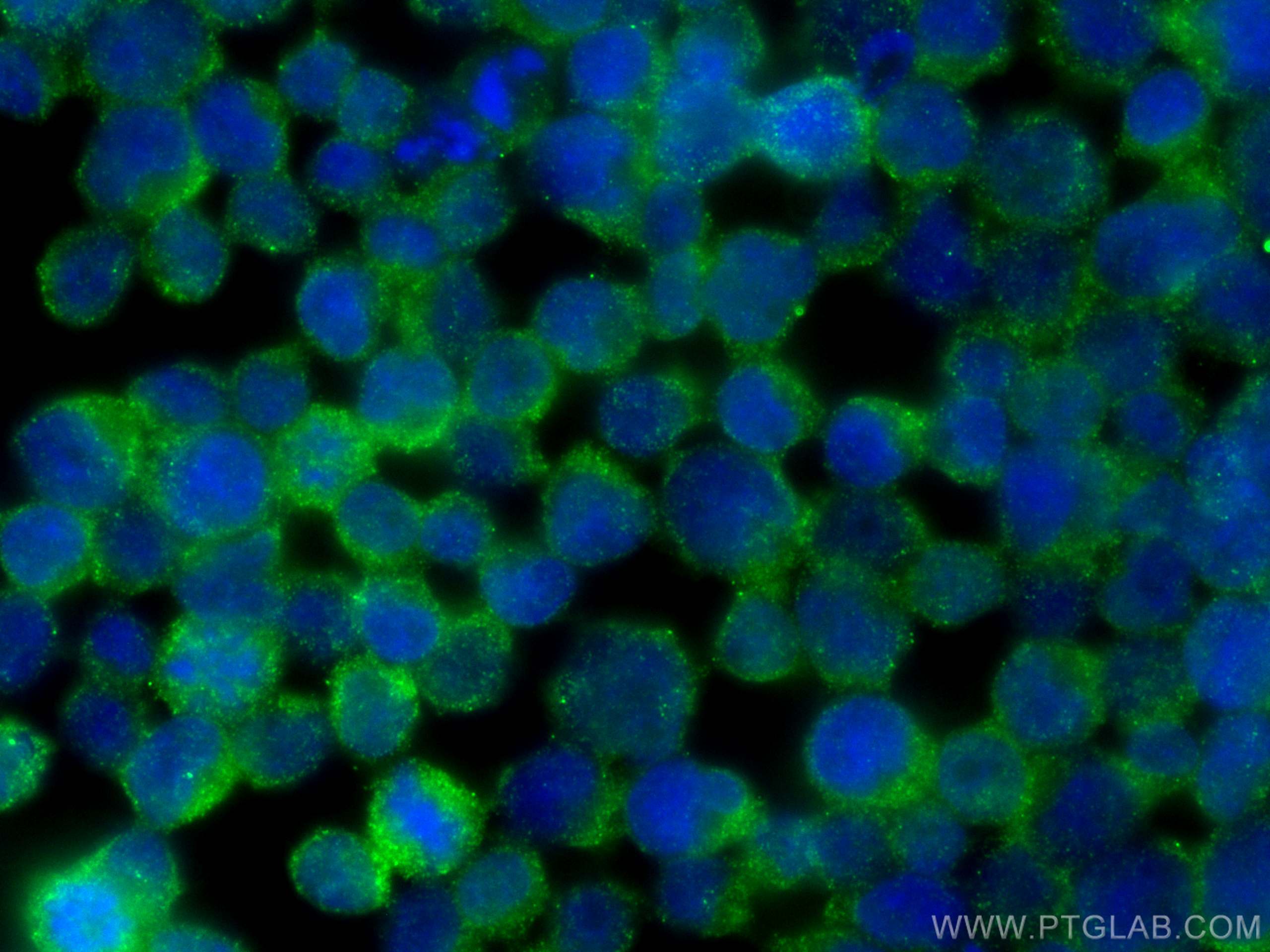 Immunofluorescence (IF) / fluorescent staining of Jurkat cells using DMXL2 Monoclonal antibody (66891-2-Ig)