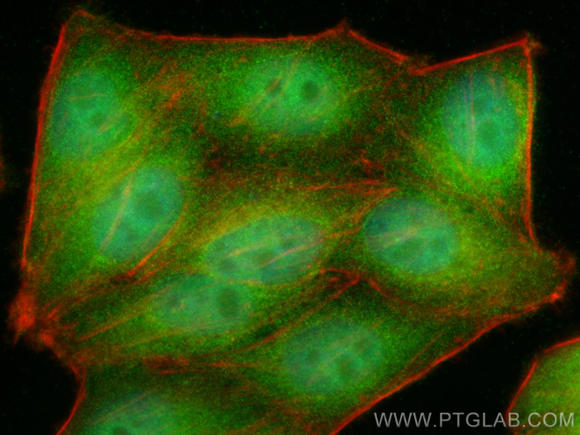 Immunofluorescence (IF) / fluorescent staining of HepG2 cells using DNA2 Polyclonal antibody (18727-1-AP)