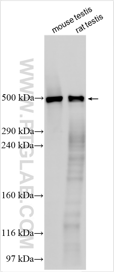 Western Blot (WB) analysis of various lysates using DNAH17 Polyclonal antibody (24488-1-AP)