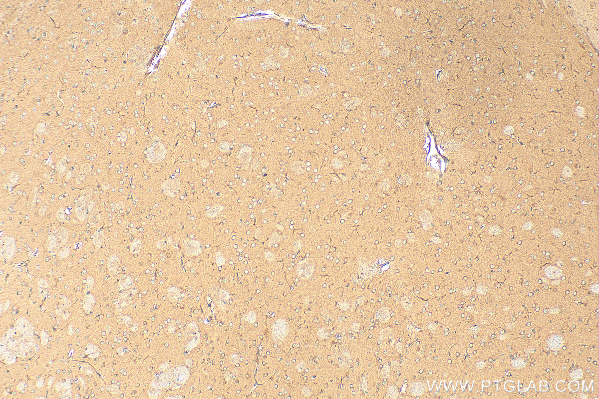 Immunohistochemistry (IHC) staining of mouse brain tissue using DNAH6 Polyclonal antibody (18080-1-AP)