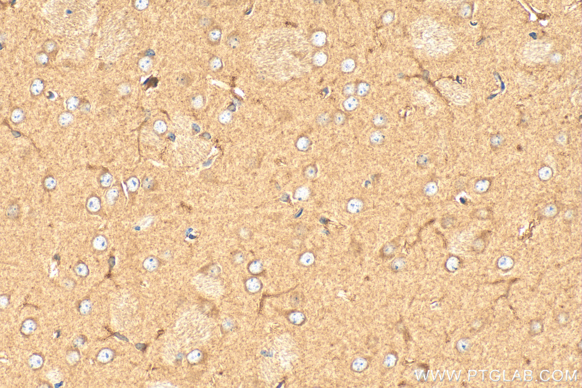 Immunohistochemistry (IHC) staining of mouse brain tissue using DNAH6 Polyclonal antibody (18080-1-AP)