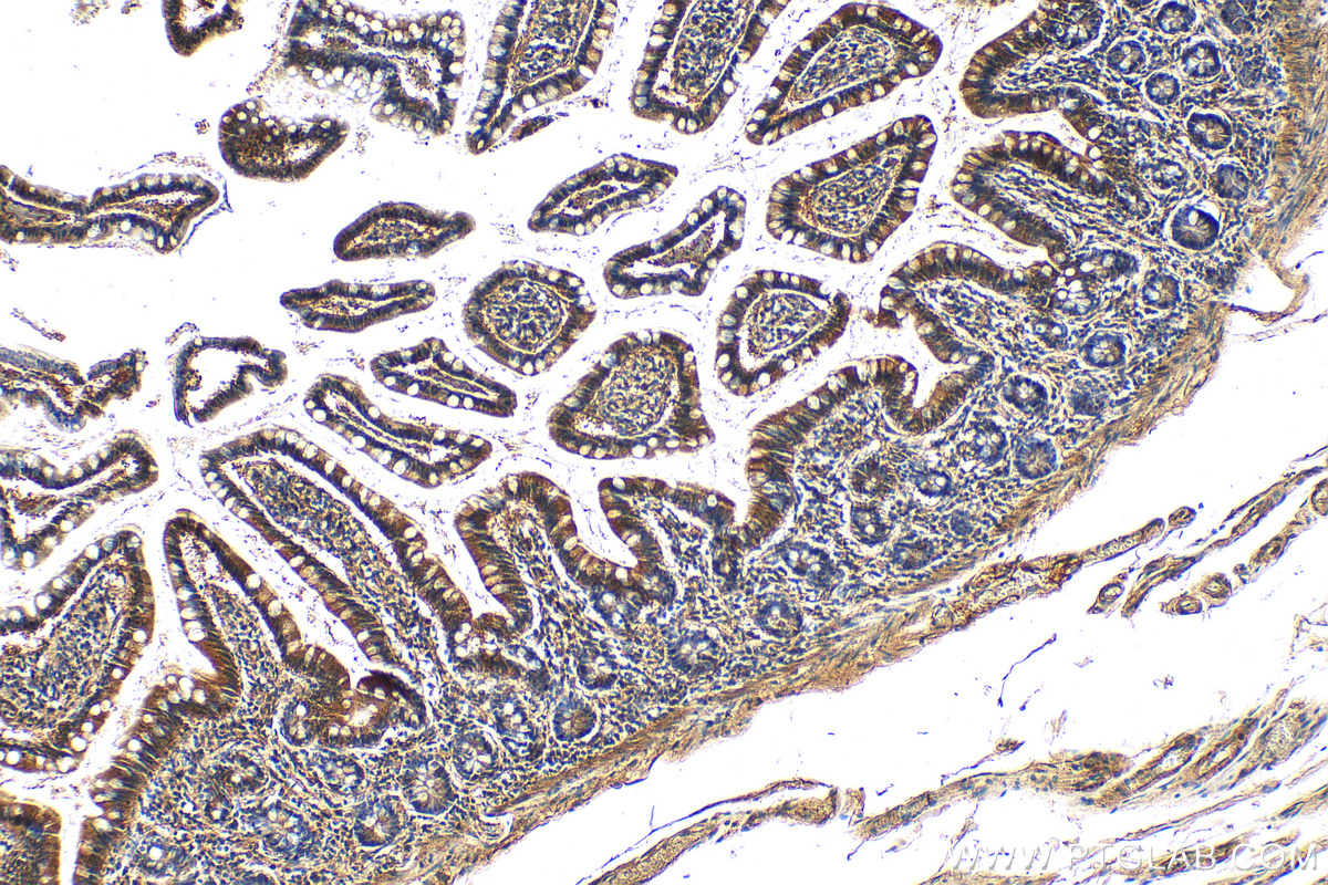 Immunohistochemistry (IHC) staining of human small intestine tissue using DNAH6 Polyclonal antibody (18080-1-AP)