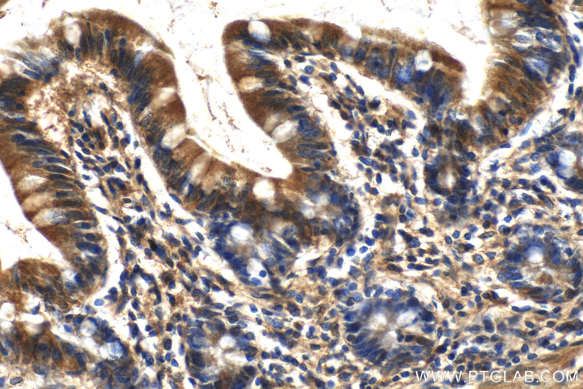 Immunohistochemistry (IHC) staining of human small intestine tissue using DNAH6 Polyclonal antibody (18080-1-AP)