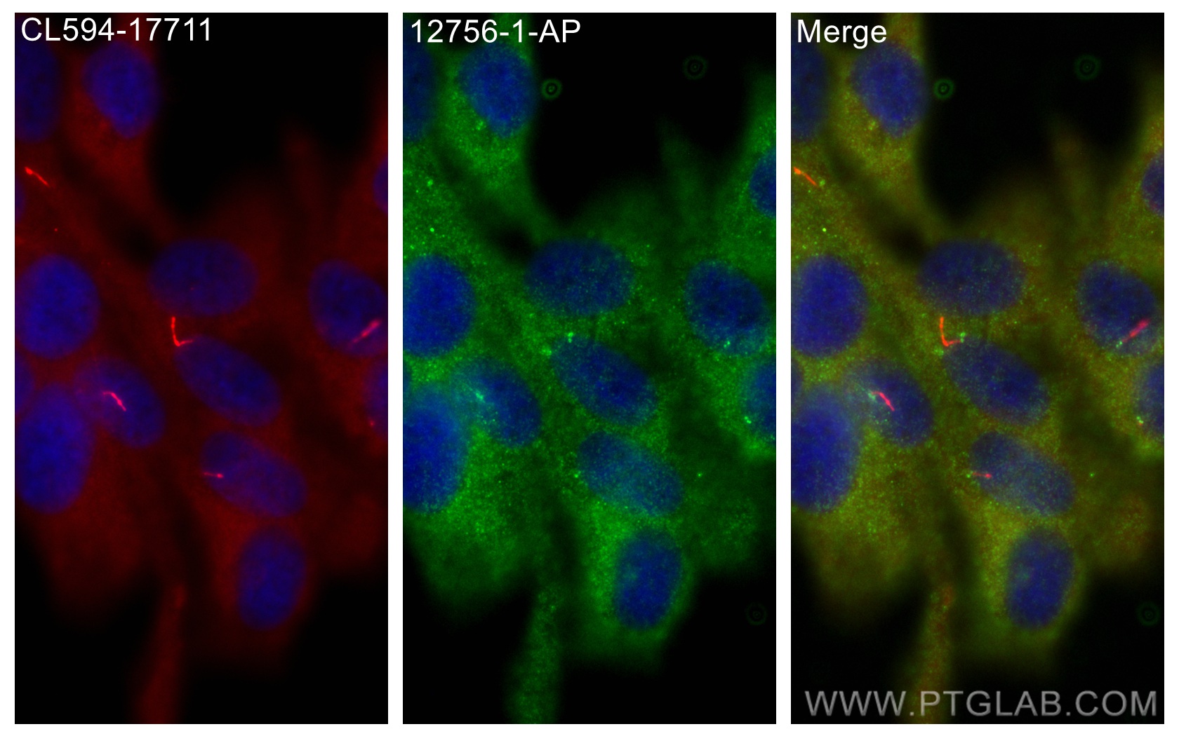 Immunofluorescence (IF) / fluorescent staining of hTERT-RPE1 cells using DNAI1 Polyclonal antibody (12756-1-AP)