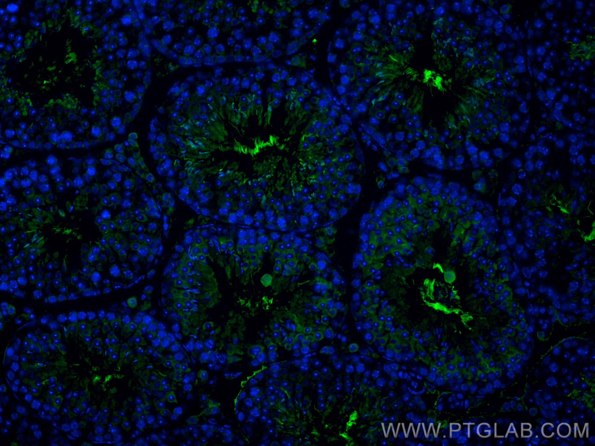 Immunofluorescence (IF) / fluorescent staining of mouse testis tissue using DNAI2 Polyclonal antibody (17533-1-AP)