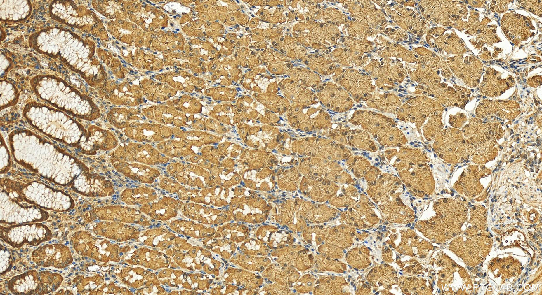 Immunohistochemistry (IHC) staining of human stomach tissue using DNAJA1 Polyclonal antibody (11713-1-AP)