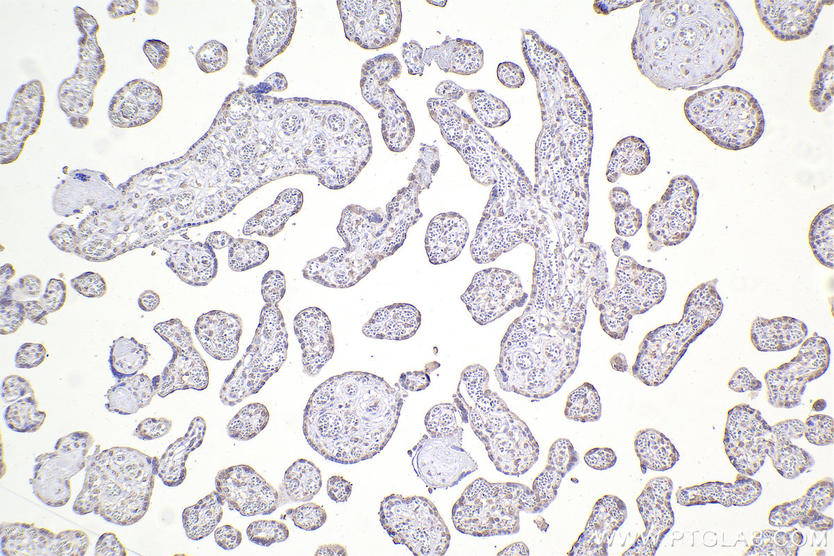 Immunohistochemistry (IHC) staining of human placenta tissue using DNAJA1 Monoclonal antibody (67184-1-Ig)