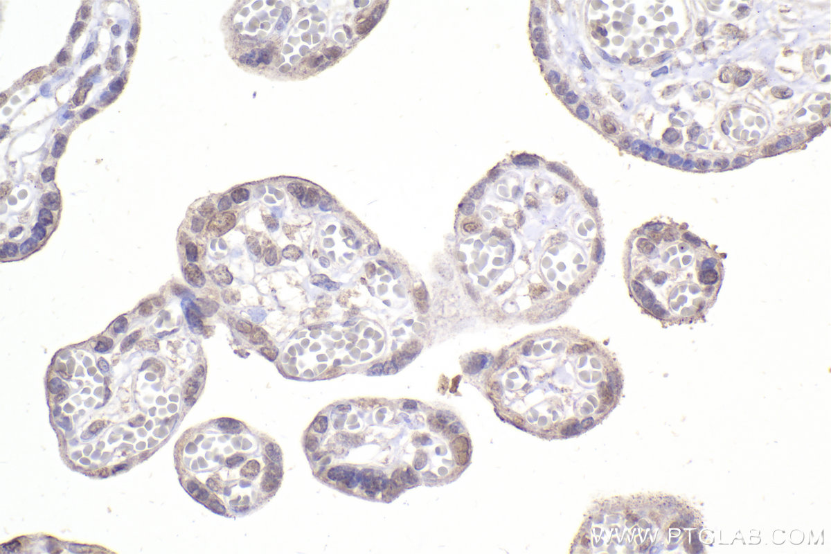 Immunohistochemistry (IHC) staining of human placenta tissue using DNAJA1 Monoclonal antibody (67184-1-Ig)