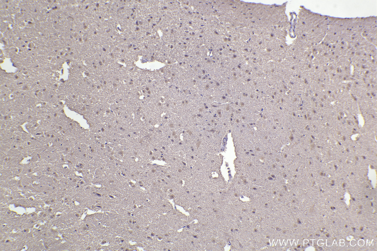 Immunohistochemistry (IHC) staining of mouse brain tissue using DNAJA1 Monoclonal antibody (67184-1-Ig)