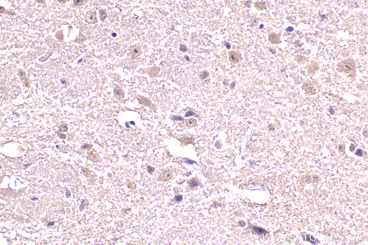 Immunohistochemistry (IHC) staining of mouse brain tissue using DNAJA1 Monoclonal antibody (67184-1-Ig)