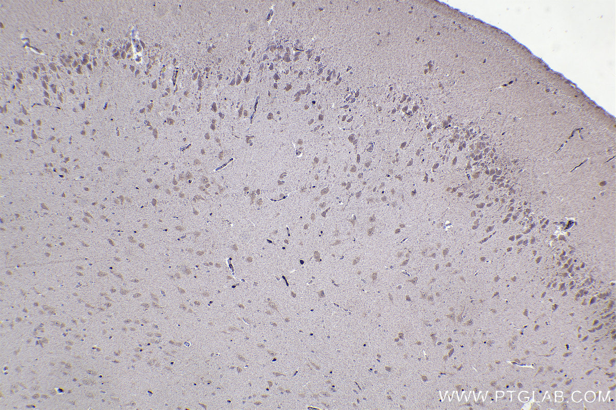 Immunohistochemistry (IHC) staining of rat brain tissue using DNAJA1 Monoclonal antibody (67184-1-Ig)